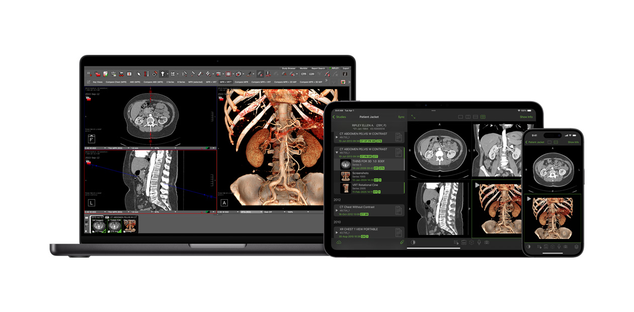 Software met de Visage-app, waarmee radiologen grote diagnostische bestanden interpreteren.